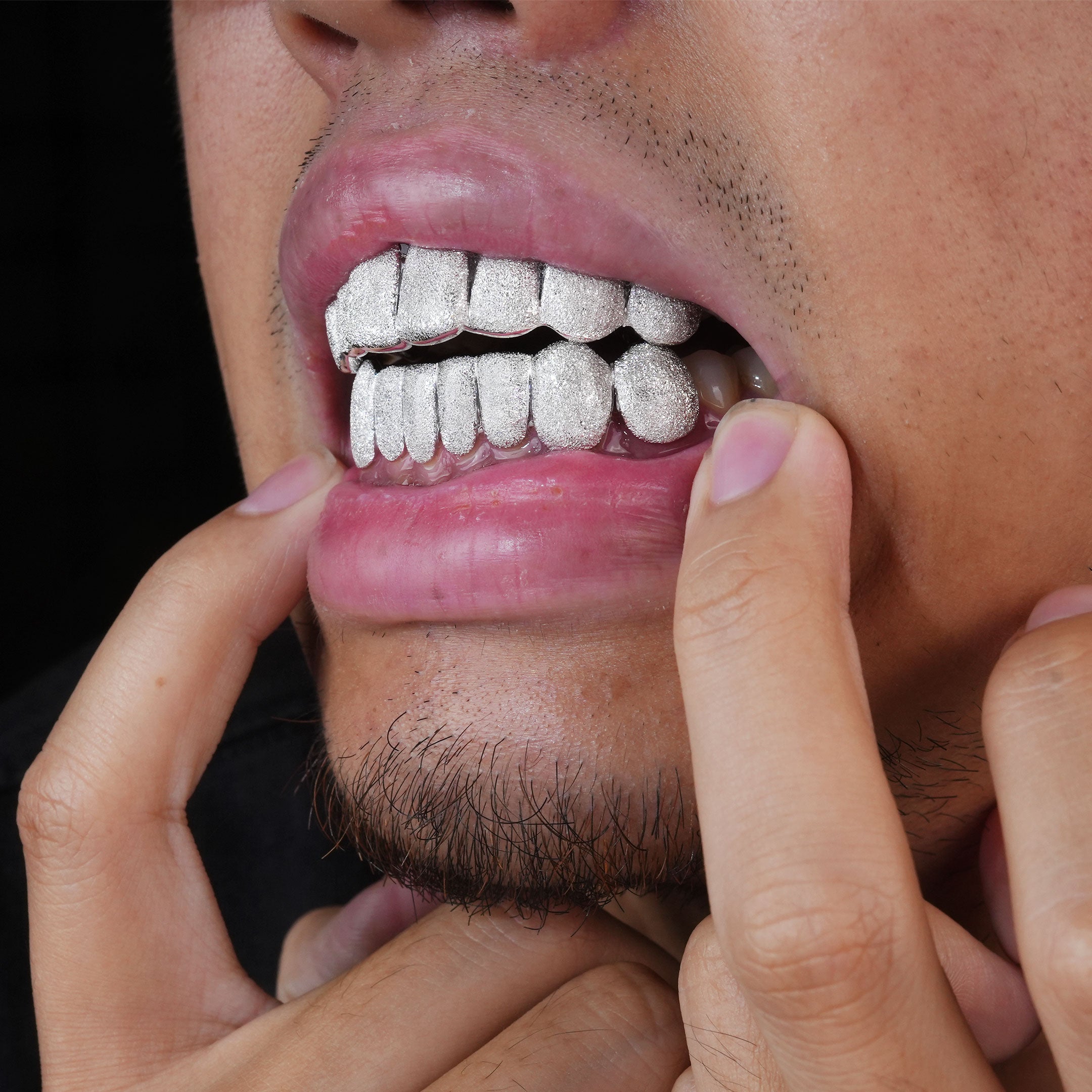 Custom Diamond Dust Grillz